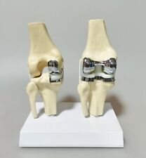 Prótese de joelho artificial destacável modelo de demonstração de ensino anatômico médico, usado comprar usado  Enviando para Brazil