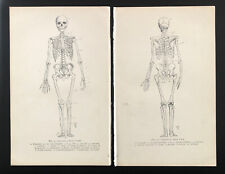 Antique print skeleton for sale  STOCKPORT
