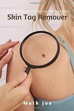 Skin tag remover for sale  UK