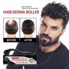 Roller hair loss for sale  Shipping to Ireland