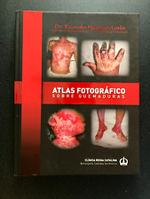 Atlas Fotografico: Sobre Quemaduras Dr. Ricardo Manzur Ayala Capa Dura comprar usado  Enviando para Brazil