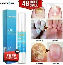 Nail fungal treatment for sale  UK