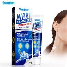 Sumifun wart removal for sale  ROMFORD