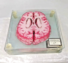 Acrylic brain specimen for sale  Colorado City