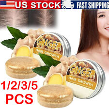 5pcs natural ginger for sale  USA