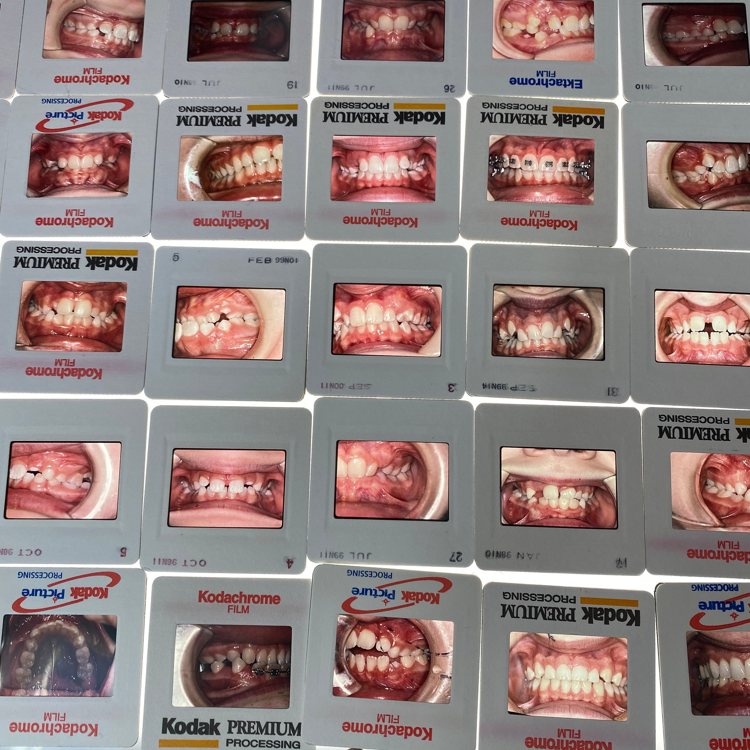 Dental 35mm slides for sale  